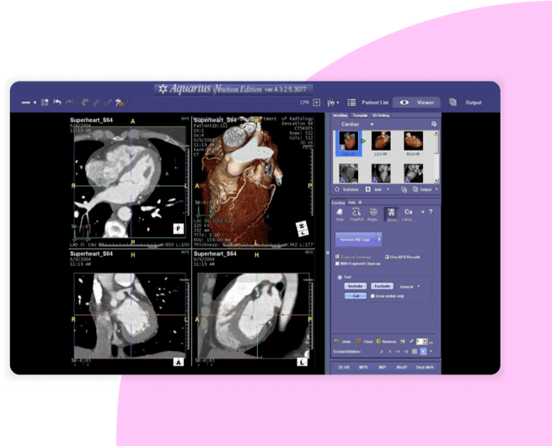 SCR-Merge-Cardio-CVIS-007-1125x912