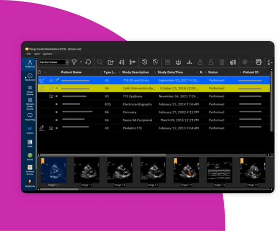 IMG-Merge-CVIS-001-1104x911