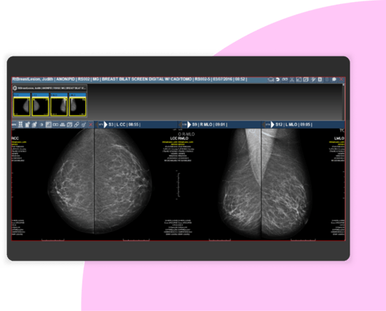 IMG-Merge-PACS-001-1125x911