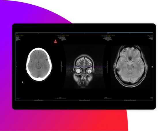 SCR-Merge-PACS-003-1104x911